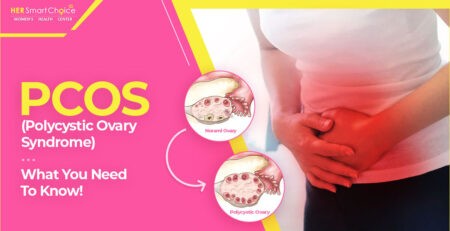 Polycystic Ovary Syndrome (PCOS)