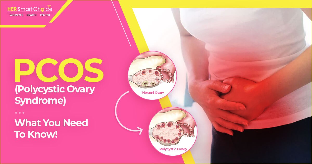 Polycystic Ovary Syndrome (PCOS)