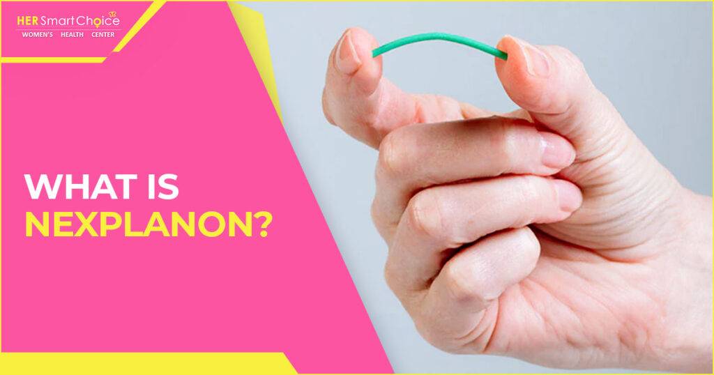 nexplanon birth control method