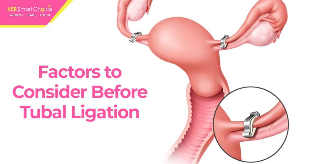 type of birth control