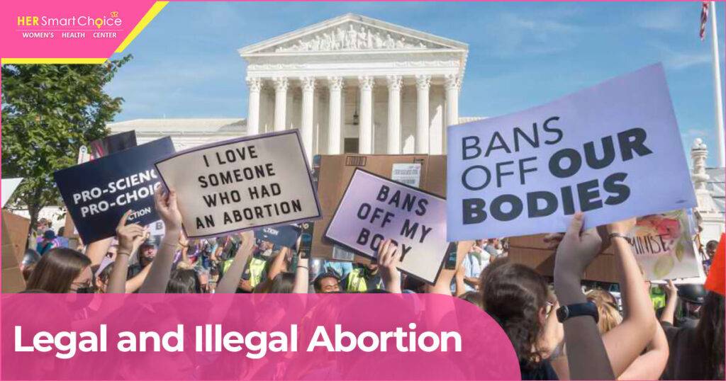 legal and illegal abortion