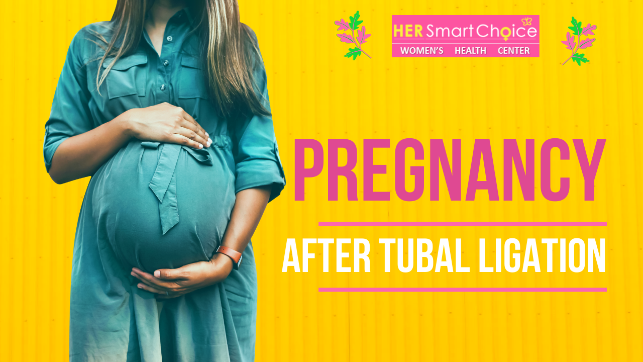 Pregnancy After Tubal Ligation
