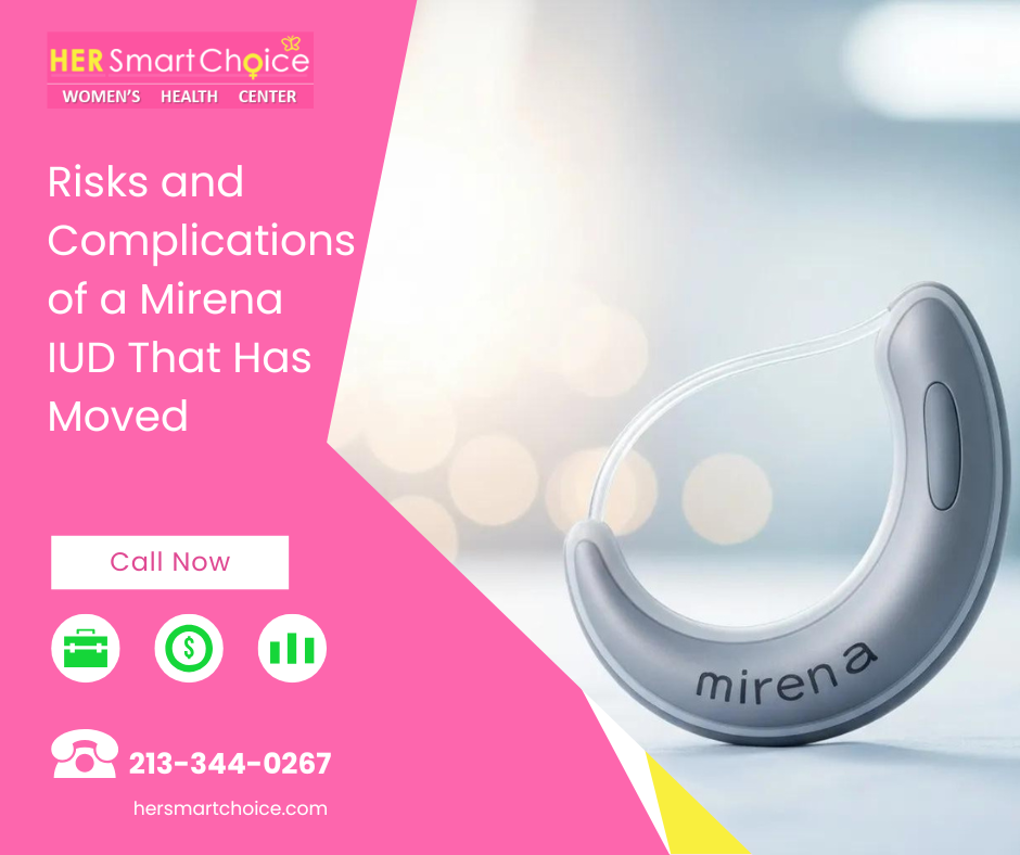 Risks and Complications of a Mirena IUD That Has Moved