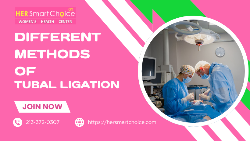 What Are the Different Methods of Tubal Ligation